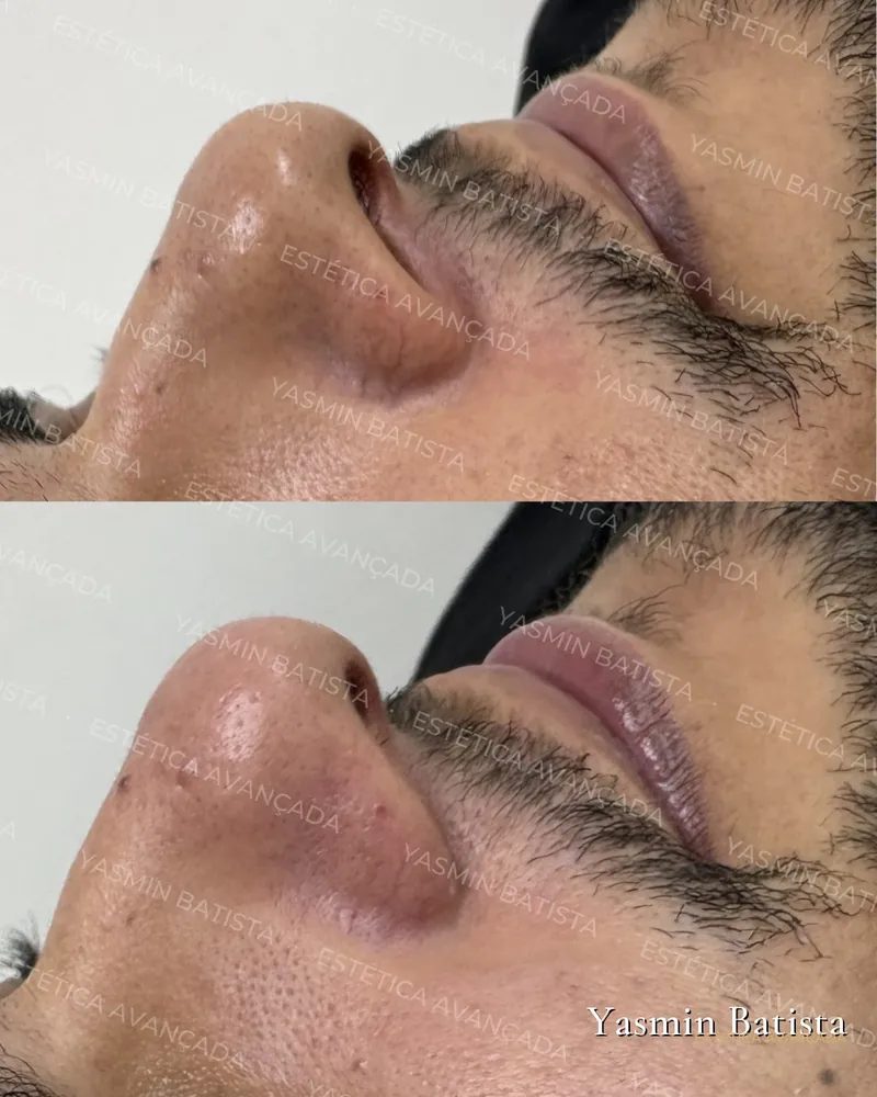 Limpeza profunda — Caso 04